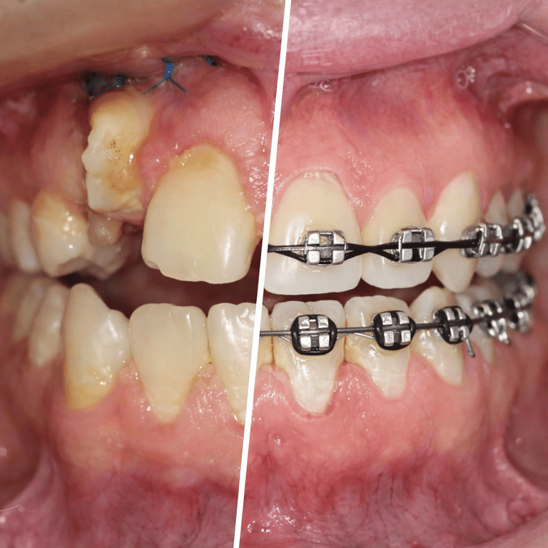 Paciente de Ortodoncia